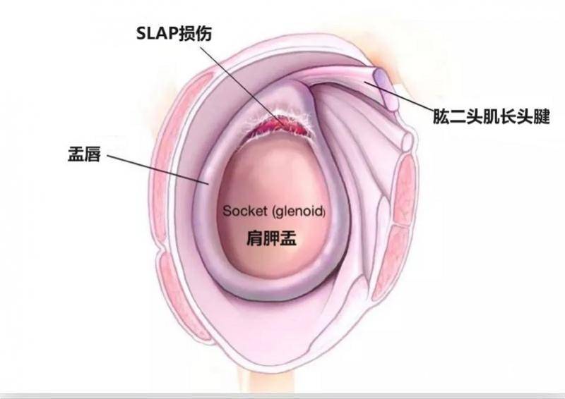 奥运引爆羽毛球热潮 医生提醒：警惕“扣杀”诱发关节受伤